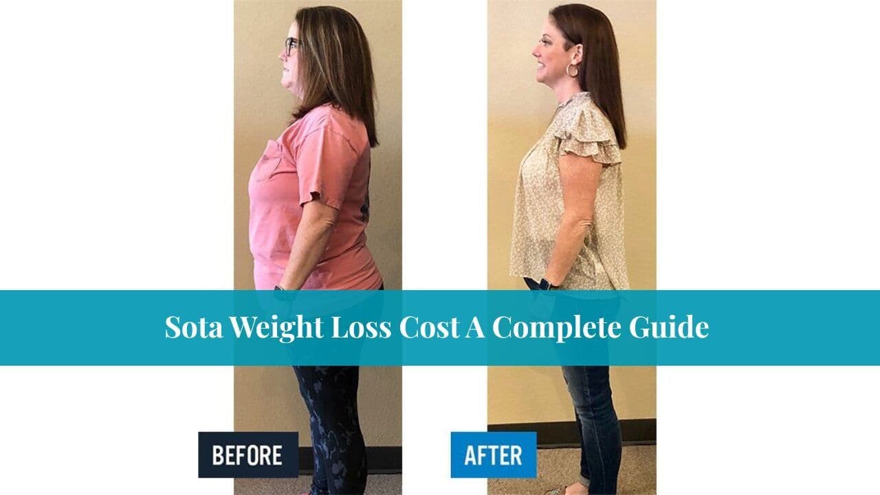 Sota Weight Loss Cost A Complete Guide
